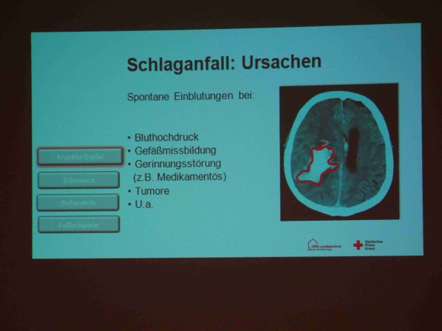 vortrag von ingo franke ber schlaganfall und die funktion eines defibrilators 2018_08